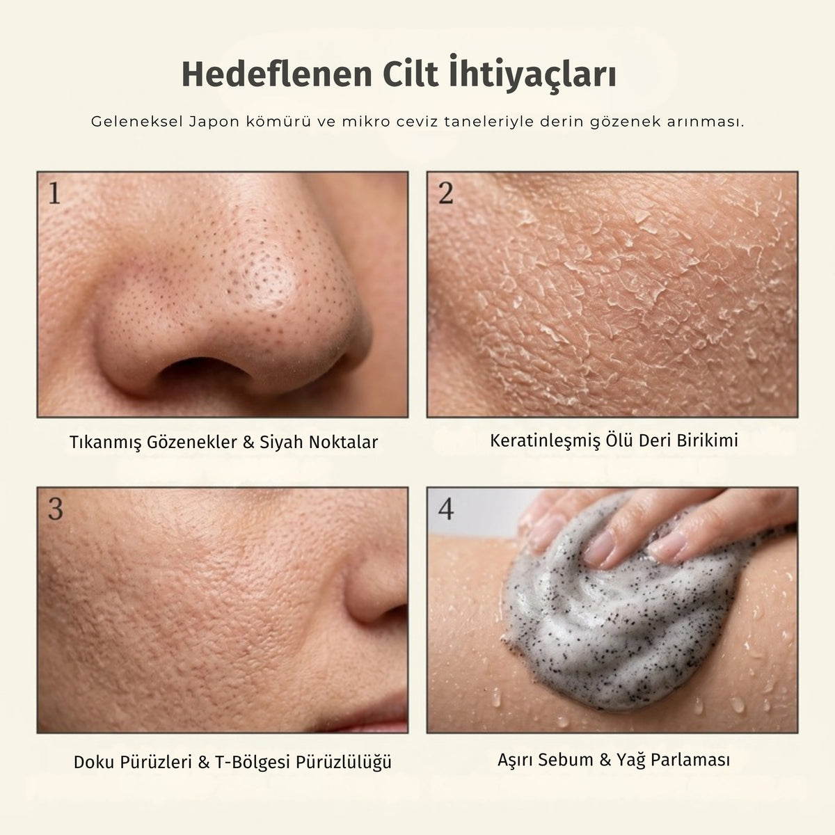Everish Charcoal Scrub'ın hedeflediği cilt ihtiyaçları: gözenek, ölü deri, pürüz ve sebum