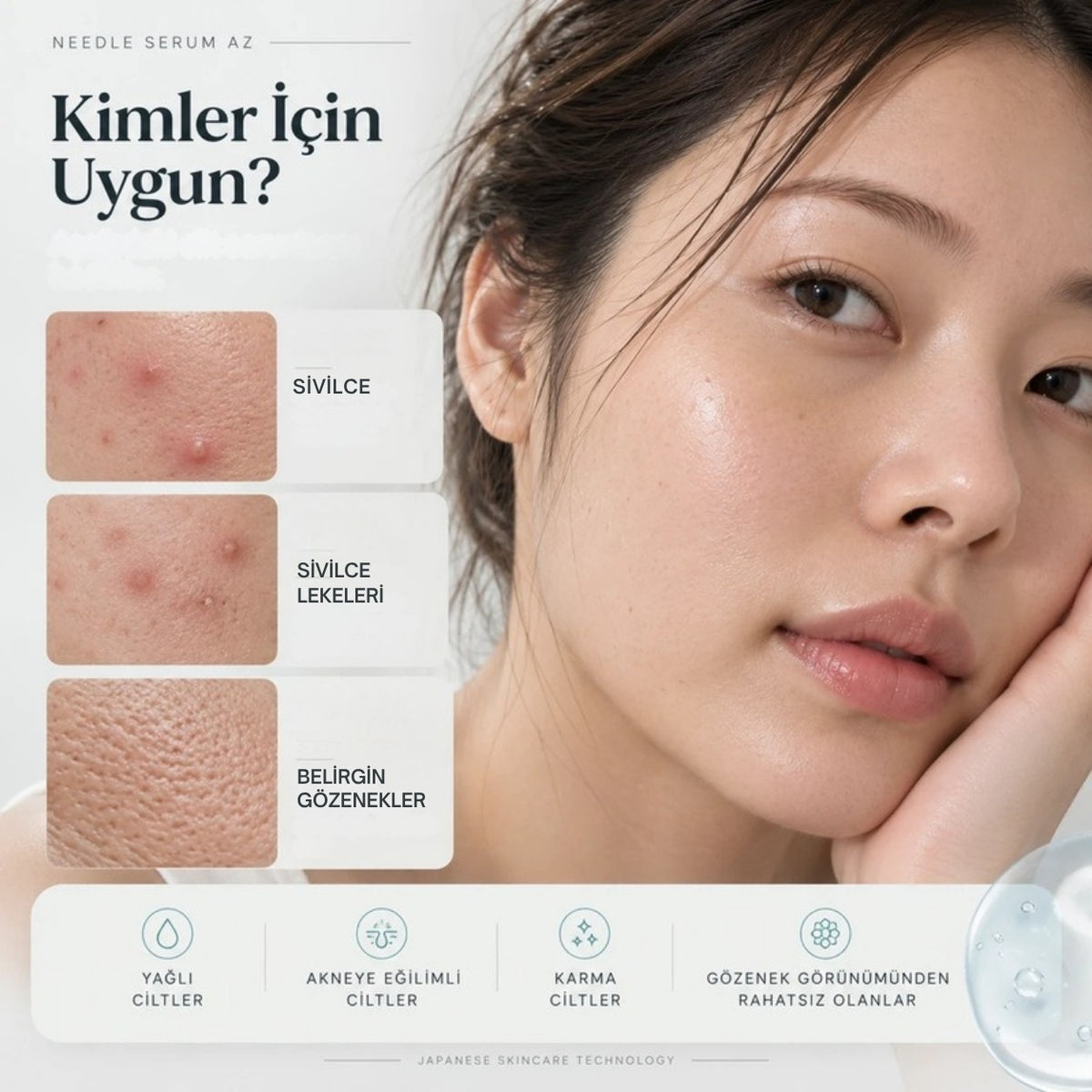 Needle Serum AZ kimler için: sivilce, sivilce lekeleri ve belirgin gözenekler