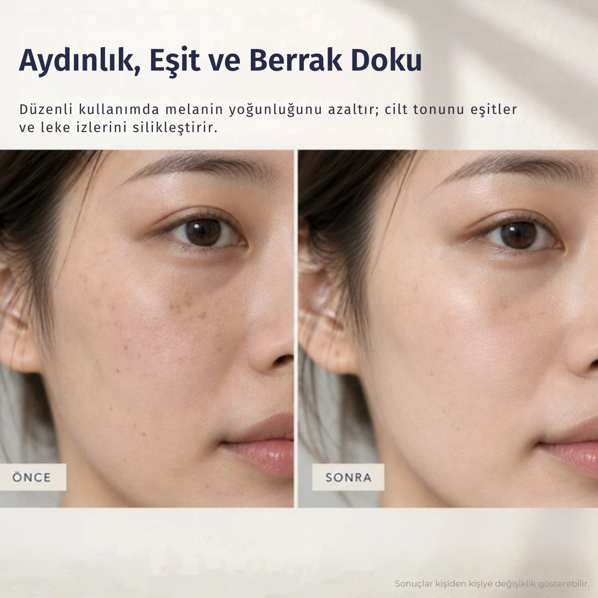 Simple Balance Whitening Gel düzenli kullanım öncesi ve sonrası cilt görünümü