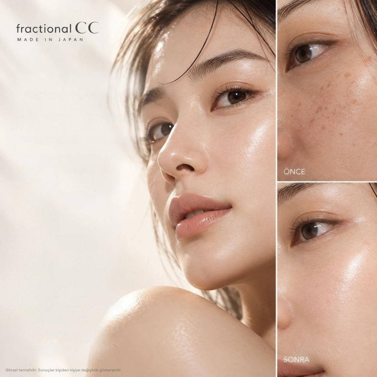 Needle Serum CX4 kullanım öncesi ve sonrası cilt görünümü
