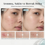 Needle Serum AZ ile düzenli gece bakımı öncesi ve sonrası cilt görünümü
