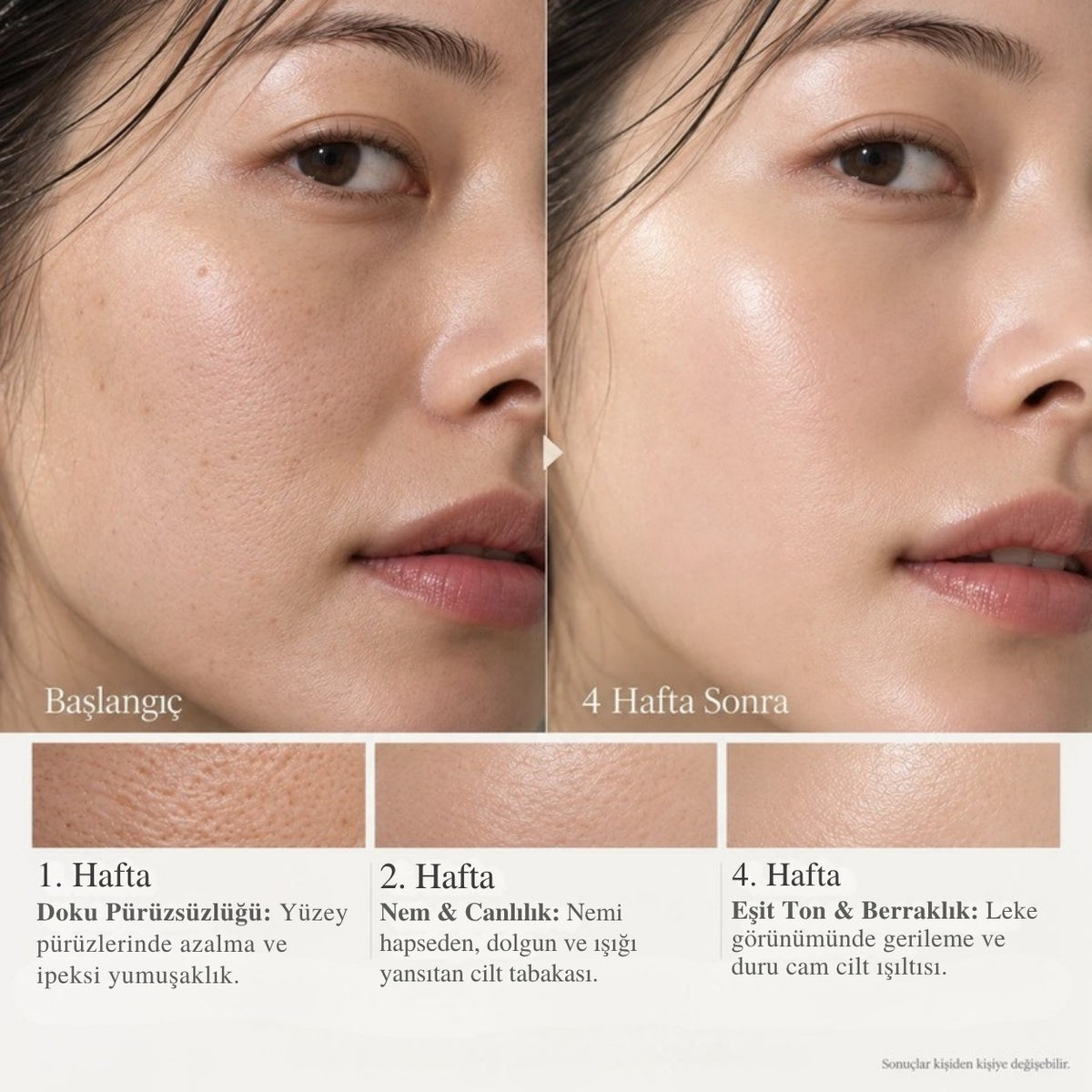 Needle Serum C başlangıç ve 4 hafta sonrası karşılaştırması